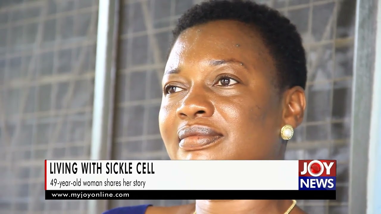 Living with sickle cell: 49-year-old woman shares her story.