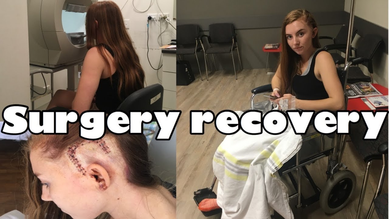 How I recovered after brain surgery | 3 month process