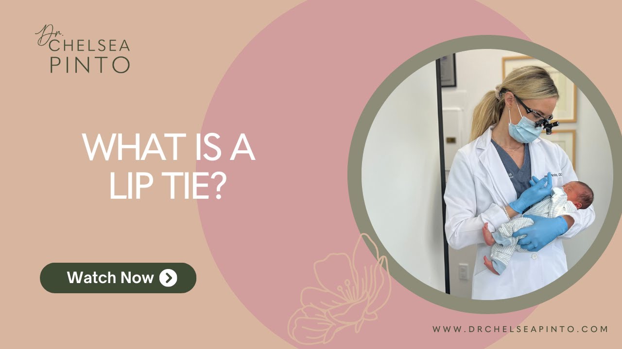 What is a Lip Tie?
