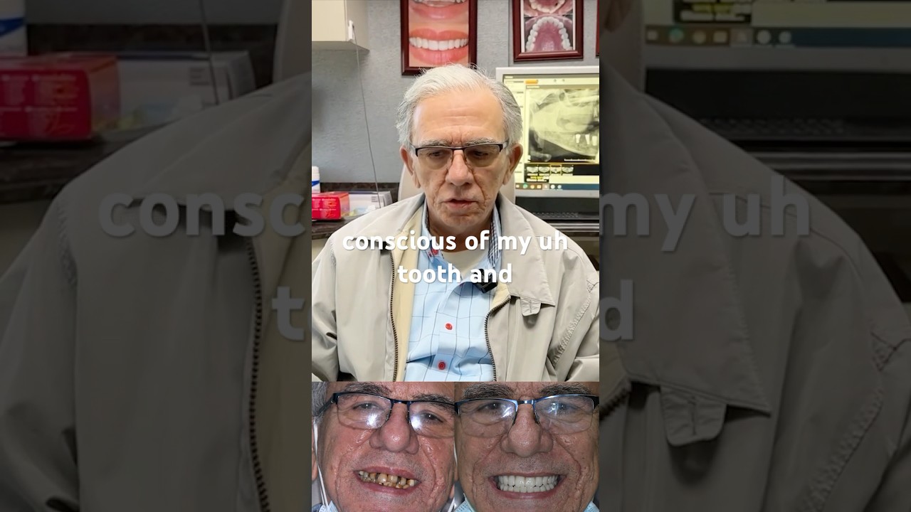 Full Arch Restoration: Final Fitting #dentist #oralsurgery #dentistry #implantdentistry