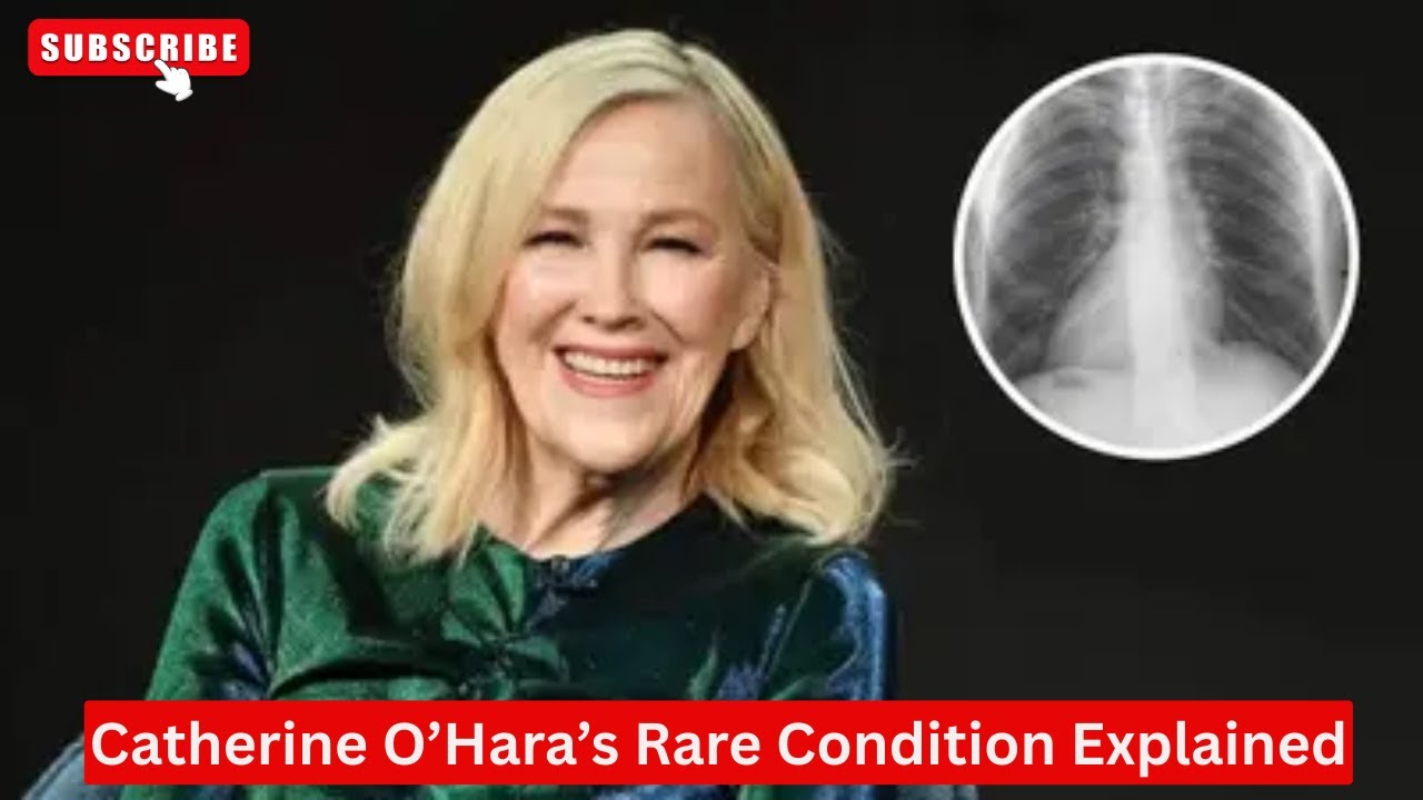 What Is Dextrocardia? Catherine O’Hara’s Rare Congenital Heart Condition Explained