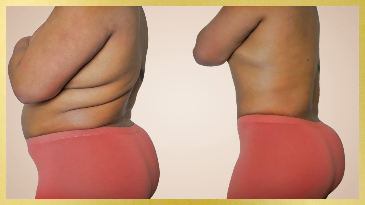 HOW I LOST BACK FAT, 40 POUNDS & BELLY FAT IN 1 MONTH BY CHANGING ONE SIMPLE THING