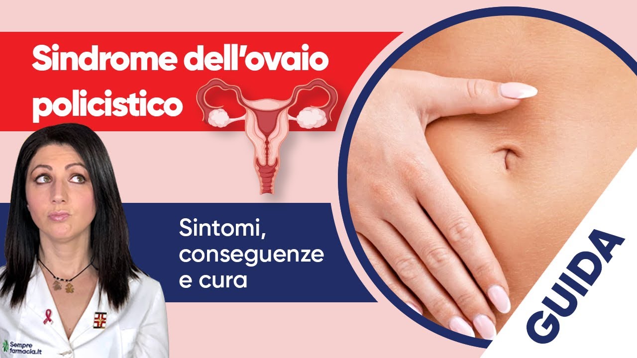 Sindrome ovaio policistico: sintomi, conseguenze e cura