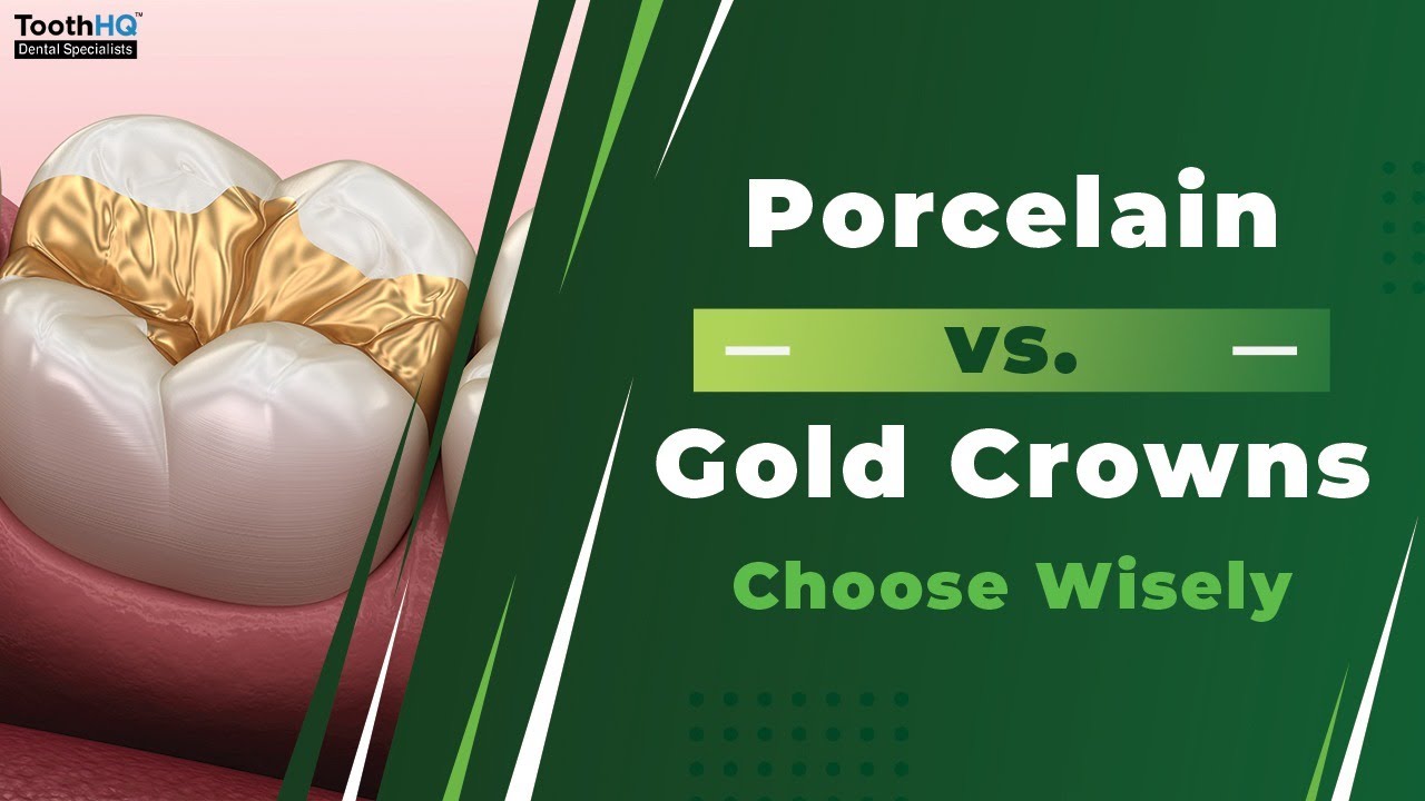 Porcelain vs. Gold Crowns: Choose Wisely
