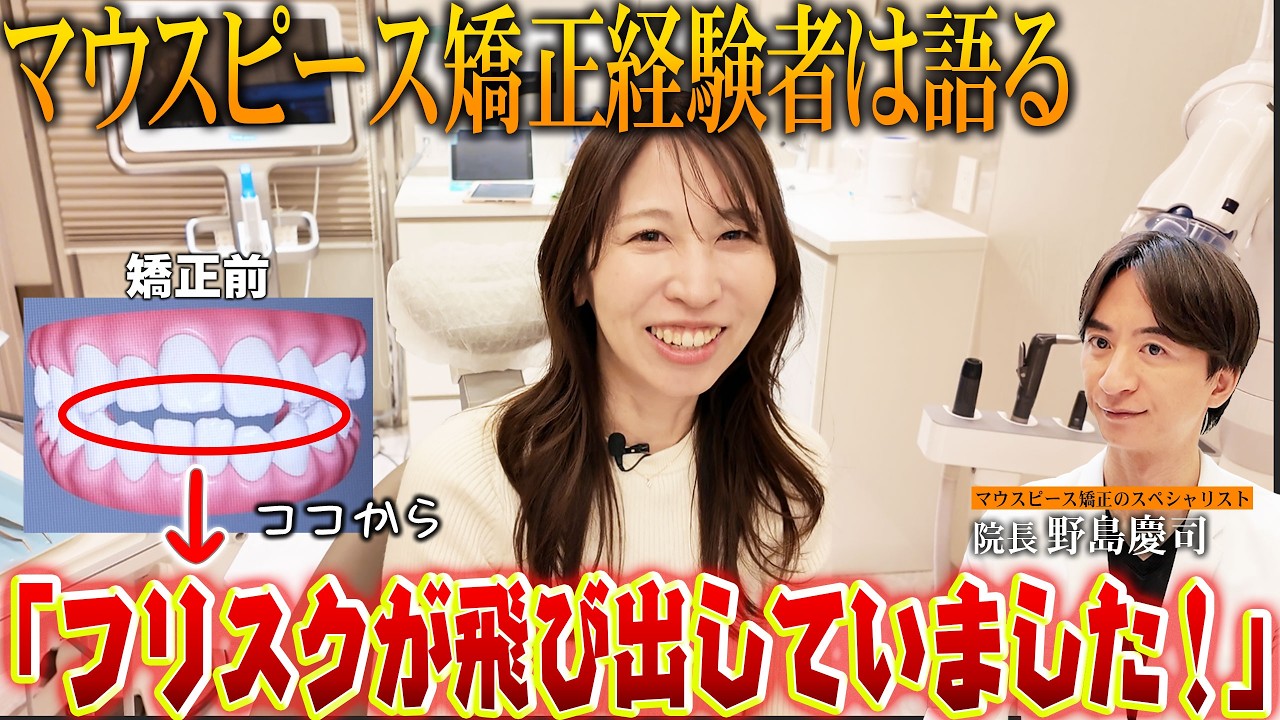 まったく前歯で噛めない…これをDr.野島は果たしてマウスピース矯正でどう治すのか？実際にあった矯正シリーズ！