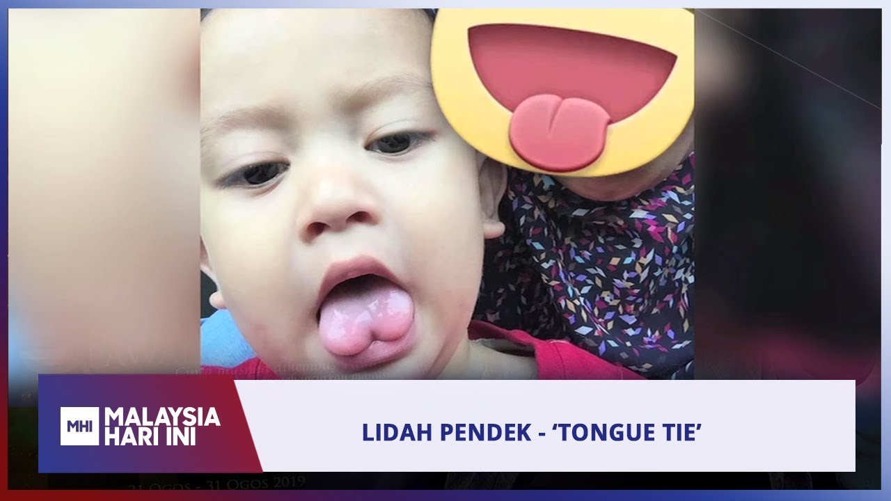 Lidah Pendek - ‘Tongue Tie’ | MHI (26 Ogos 2019)