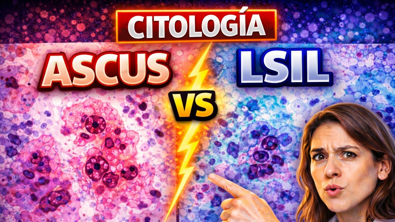 ASCUS VS LSIL. LESIONES DE BAJO GRADOI EN CUELLO UTERINO Y ATIPIAS INESPECIFICAS.