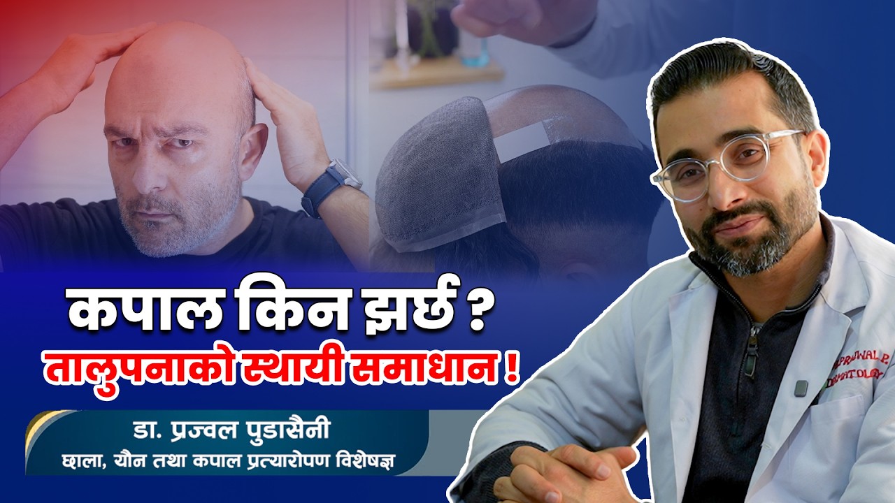कपाल झर्नबाट कसरी बच्ने ? झरे के गर्ने ? | TeleOPD