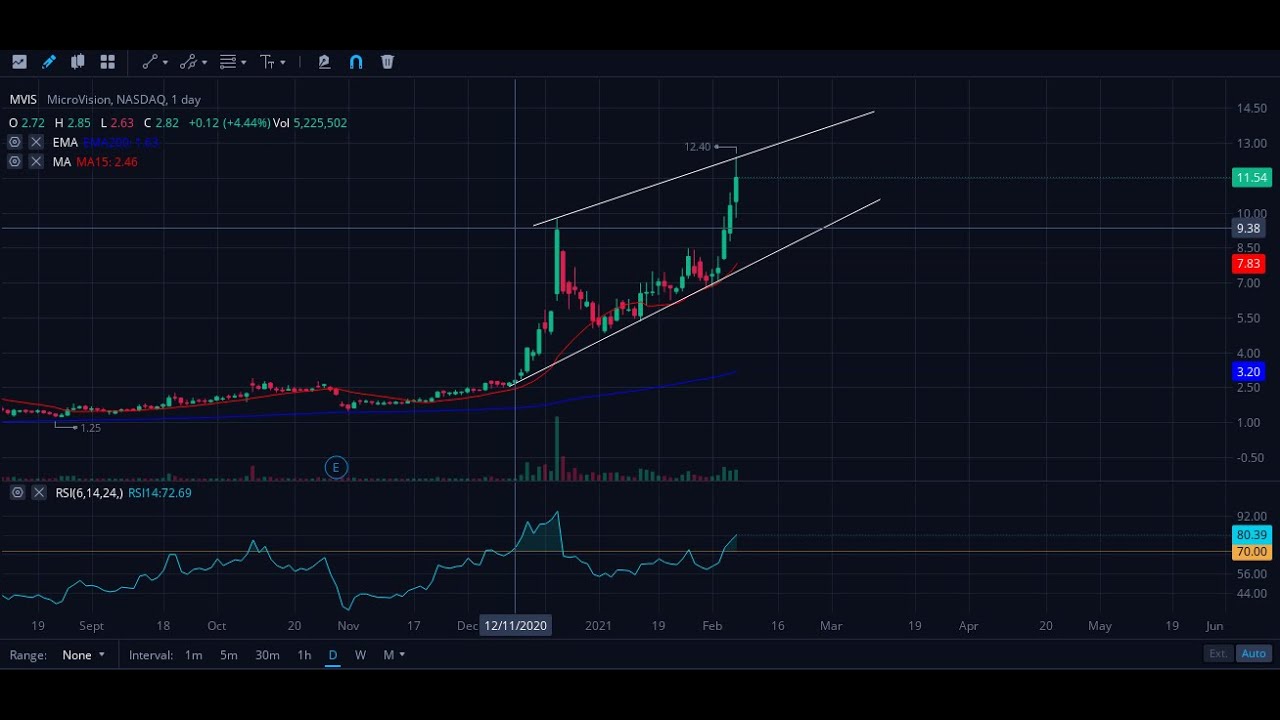 MVIS Technical Analysis, Fundamental Breakdown, Microvision