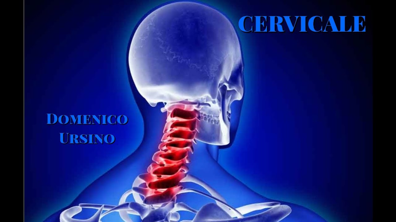 CERVICALE di Domenico Ursino