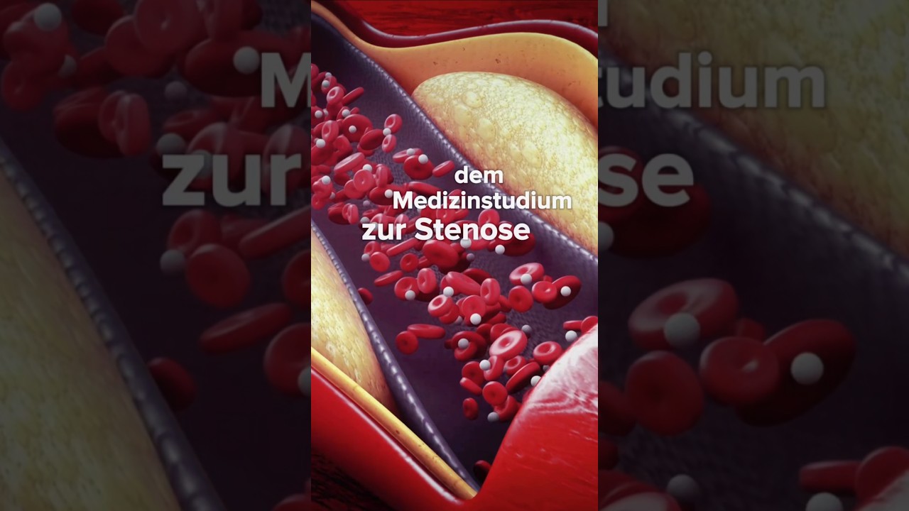 🩸 Stenose Flie&szlig;geschwindigkeit - Kontinuit&auml;tsgleichung #medizinstudium #physik #stenose #physikum