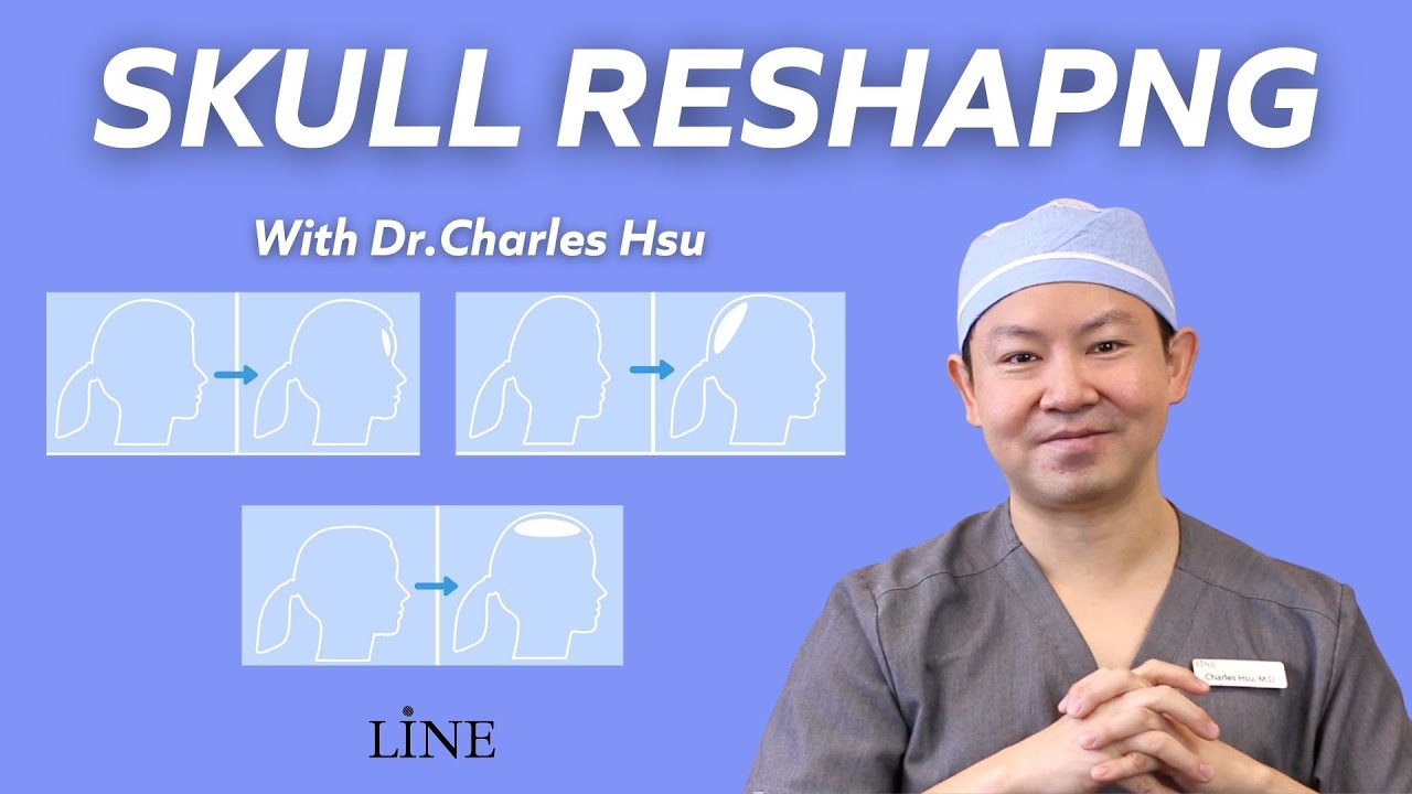 ИЗМЕНЕНИЕ ФОРМЫ ЧЕРЕПА с доктором Чарльзом Сю — Центр пластической хирургии Line в Лос-Анджелесе ...
