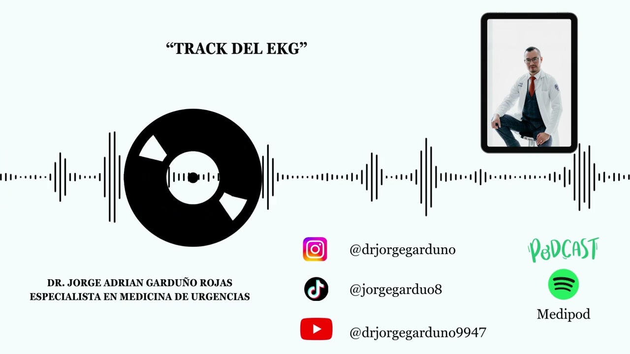 Track del EKG
