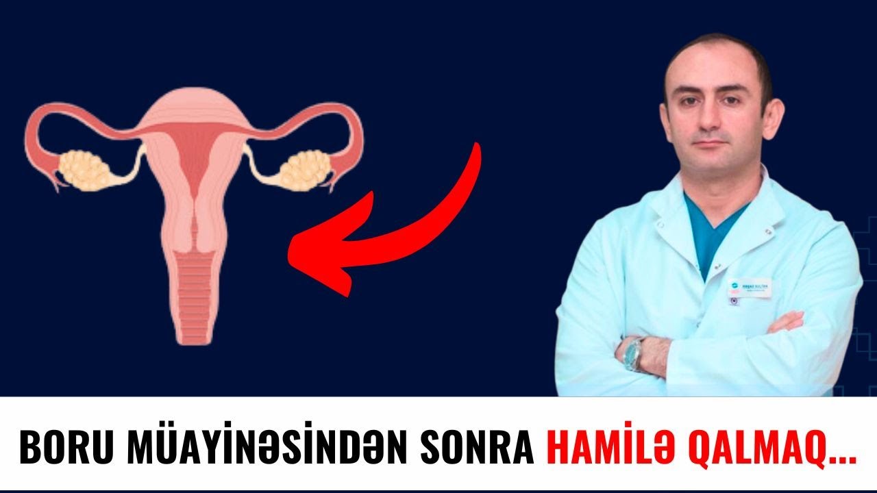 Boru Müayinəsindən Neçə Gün Sonra Hamilə Qalmaq Olar?