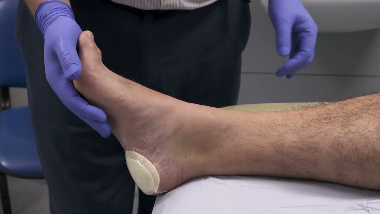 5 nhs peripheral vascular assessment  pulse palpation popliteal and foot pulse palpation
