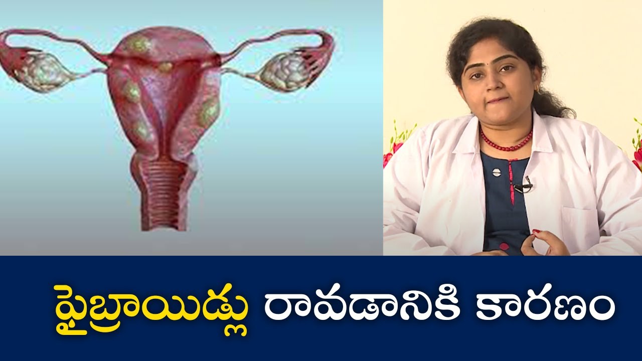 Cause of Fibroids | ఫైబ్రాయిడ్లు రావ‌డానికి కారణం | Samayam Telugu