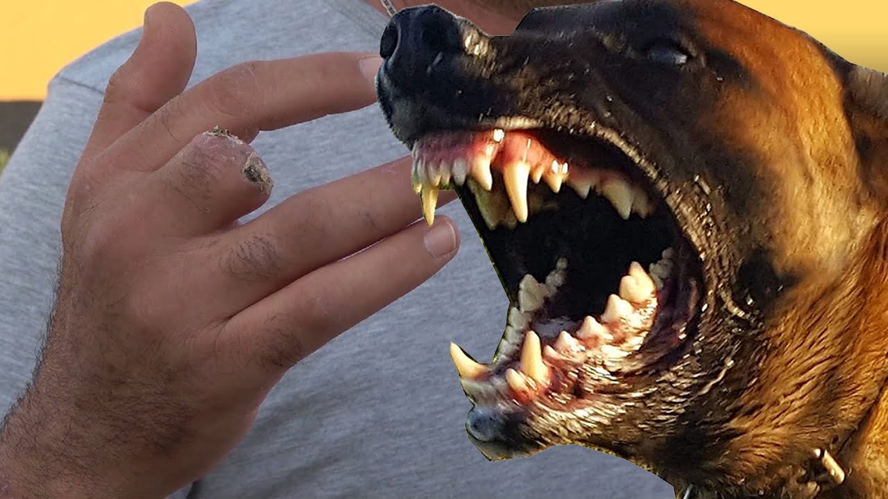 PARMAK NASIL KOPTU - SAHİBİNİ YİYEN KÖPEKLER