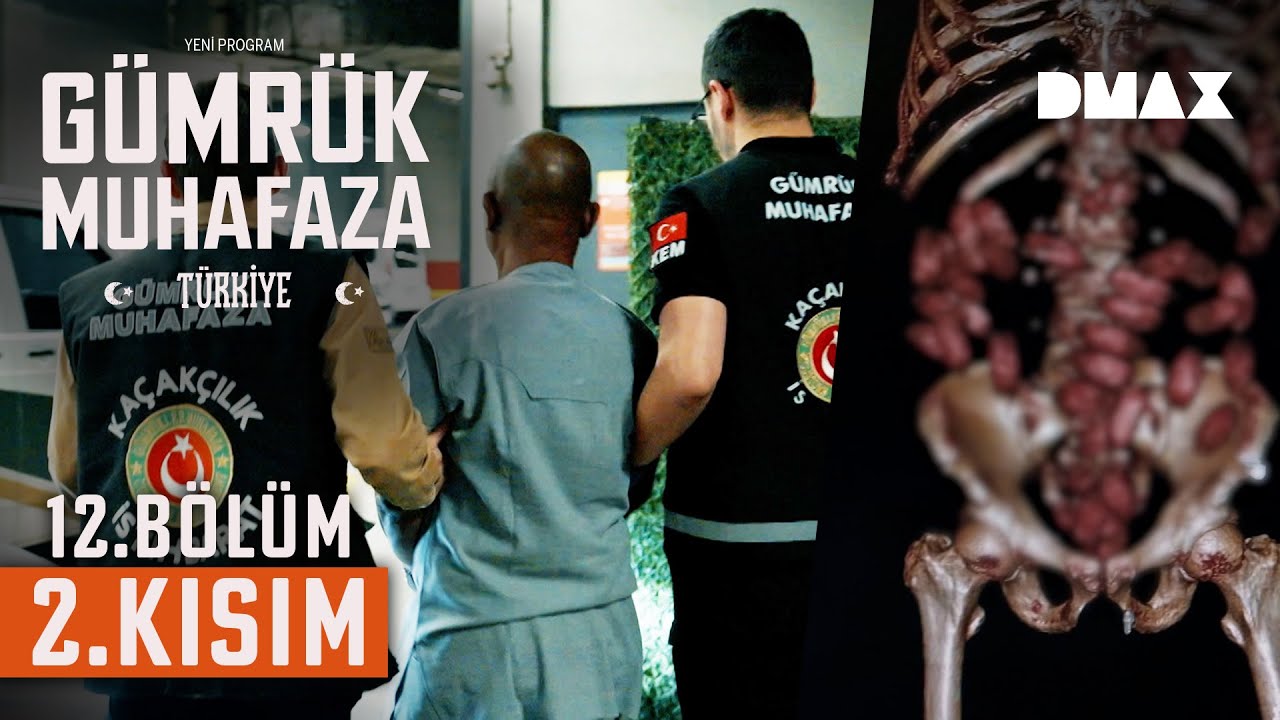 Yolcunun Midesinde Yasaklı Madde Yakalandı | Gümrük Muhafaza Türkiye 12. Bölüm 2. Kısım