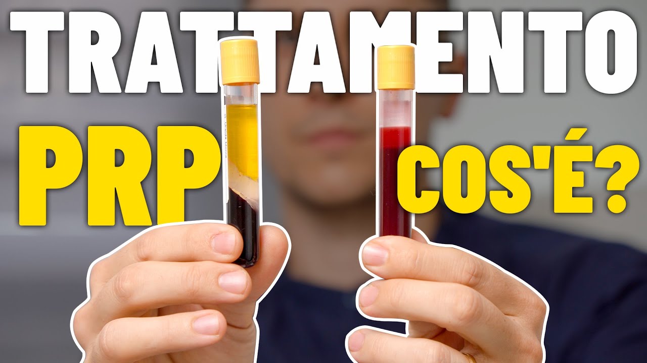 TRATTAMENTO PRP - Capelli e Volto: Tutto quello che Devi Sapere | Dr. Claudio Maestrini