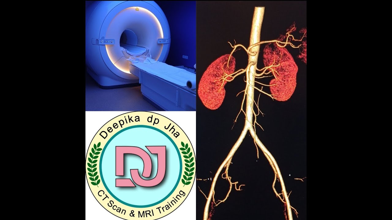 CT RENAL ANGIOGRAPHY with bolus tracking on Philips 128 slice