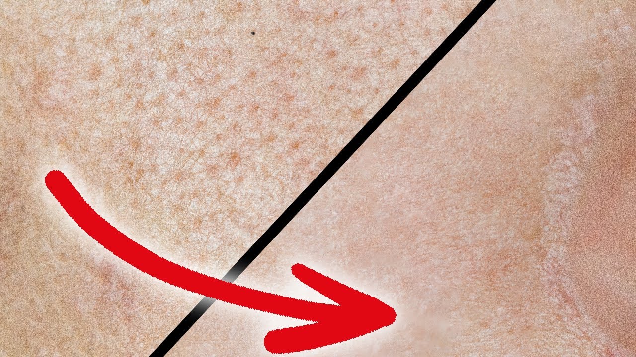 Gro&szlig;e Poren in Sekunden verschwinden lassen (klappt wirklich!)