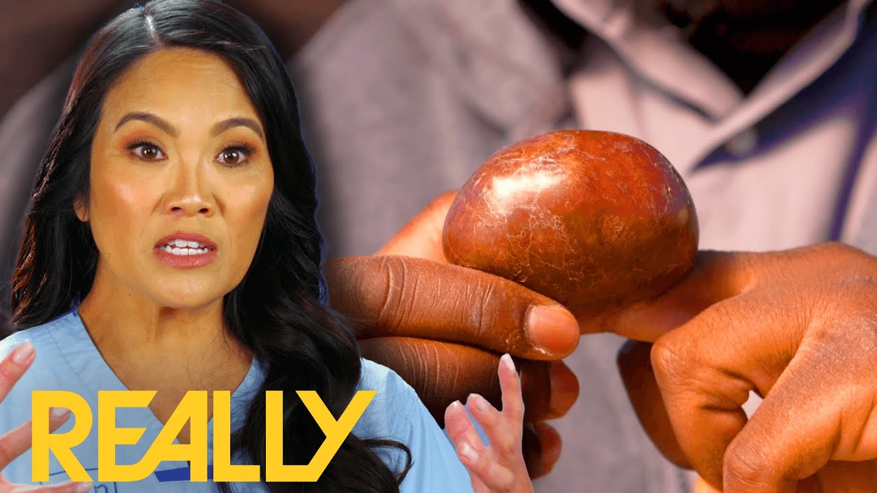 Dr. Lee Calls In A Specialist To Transform Gerard&rsquo;s Finger And Change His Life I Dr. Pimple Popper