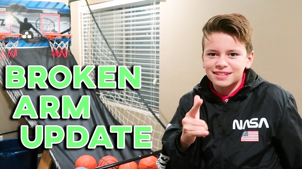 BROKEN ARM UPDATE | BROKEN ARM BEFORE CHRISTMAS | HOPING IT HEALS IN TIME