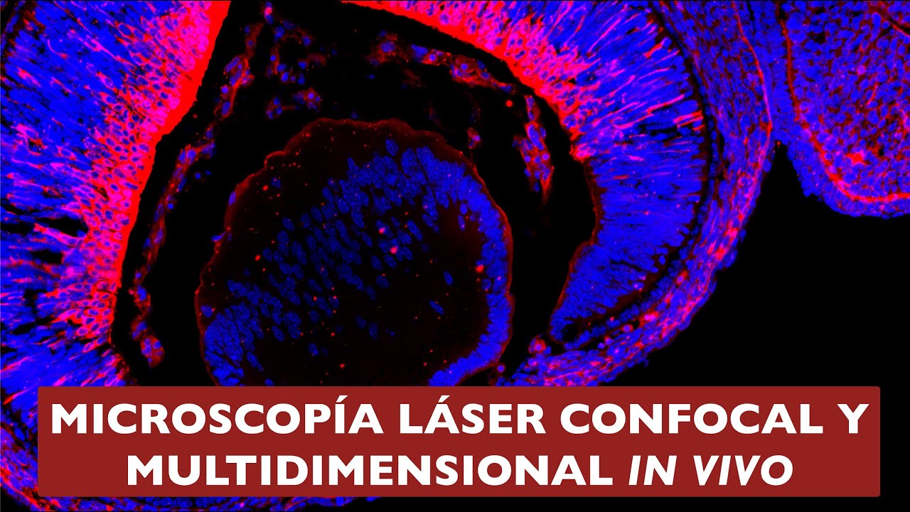 Servicio de Microscopía Láser Confocal y Multidimensional In Vivo del CIB Margarita Salas