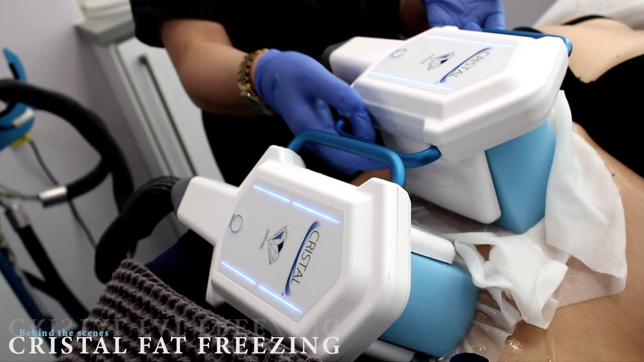 Cristal Fat Freezing- Behind the Scenes