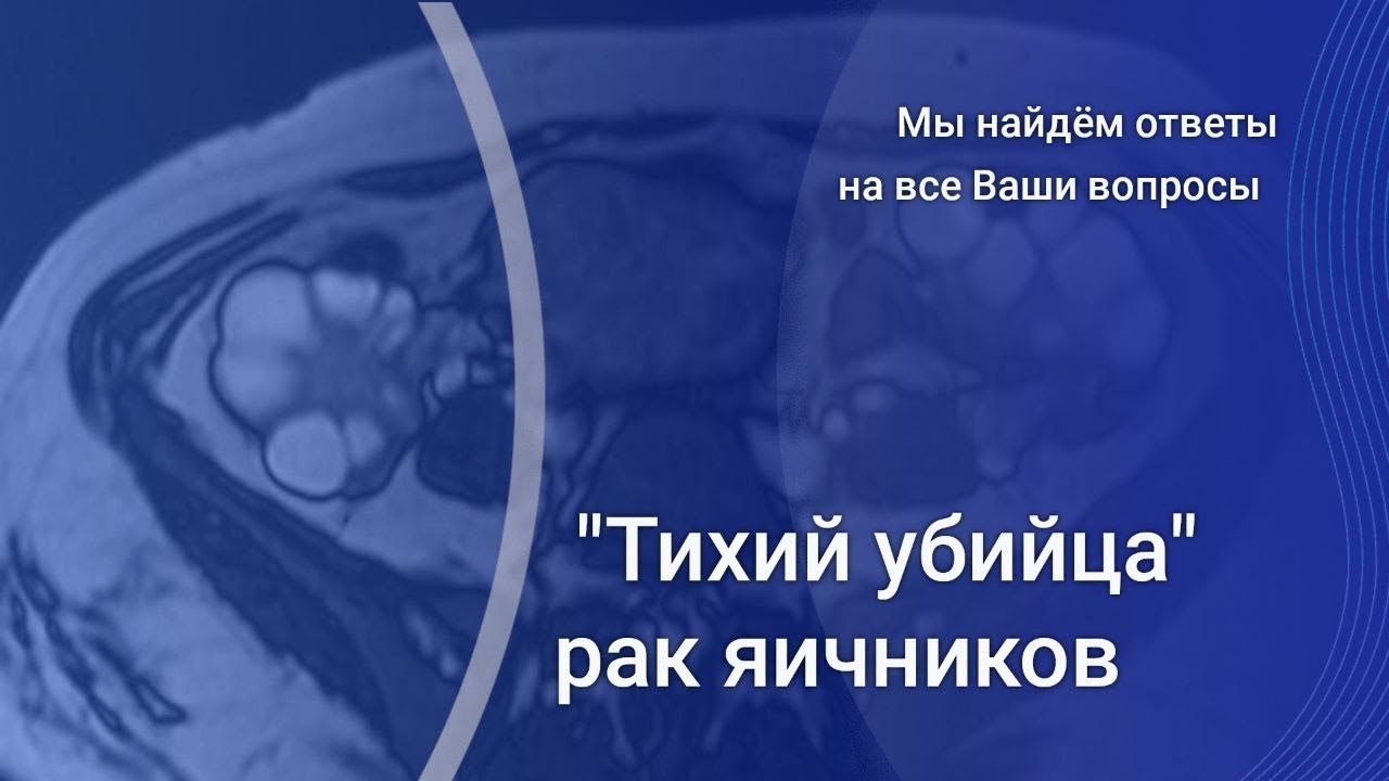 Возможности МРТ в диагностике рака яичников
