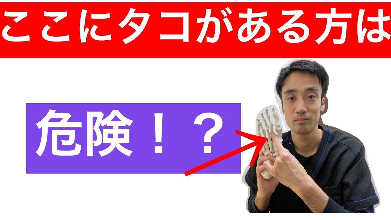 浮指解消トレーニング方法。ここにタコがある方は危険！！｜足の悩み解消専門チャンネル