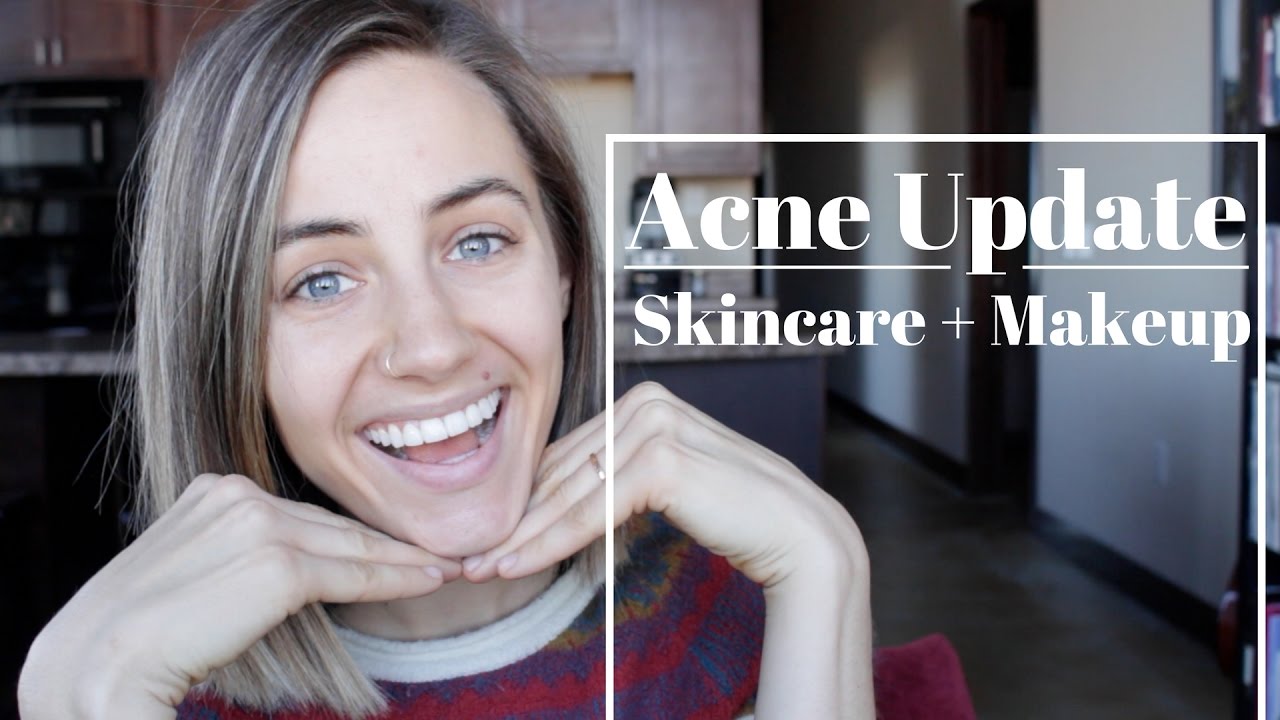 Acne Update | Skincare + Makeup Products