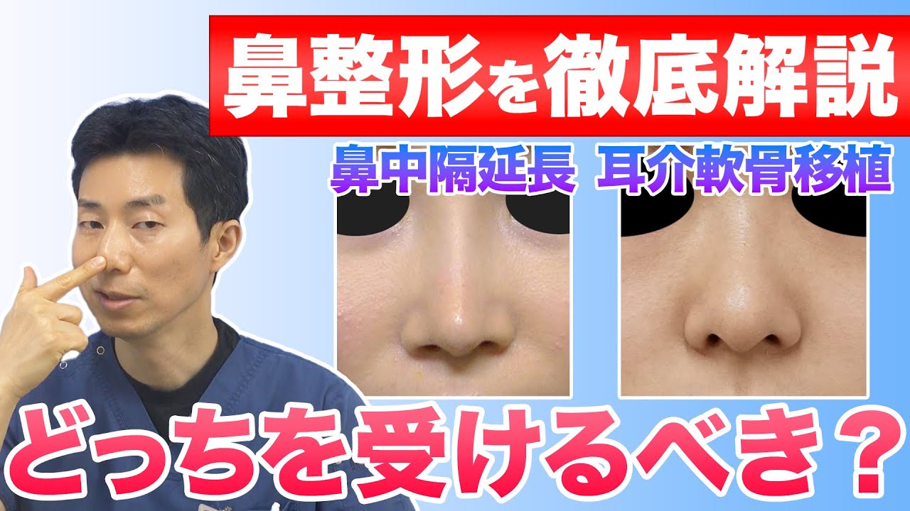 【鼻整形】鼻先は鼻中隔延長と鼻尖形成のどちらを受けるべき？