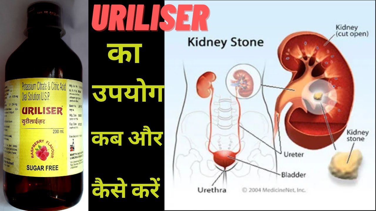 uriliser syrup use in Hindi benefit how to use uriliser syrup side effects