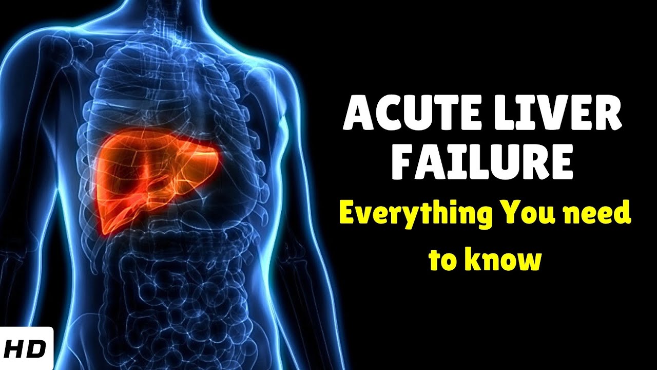 Acute Liver Failure &ndash; Causes, Signs and Symptoms, Diagnosis & Treatment