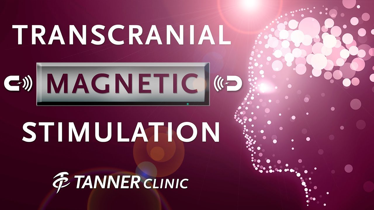 What is Transcranial Magnetic Stimulation TMS?  Dr. Van Leeuwen from Tanner Clinic Answers