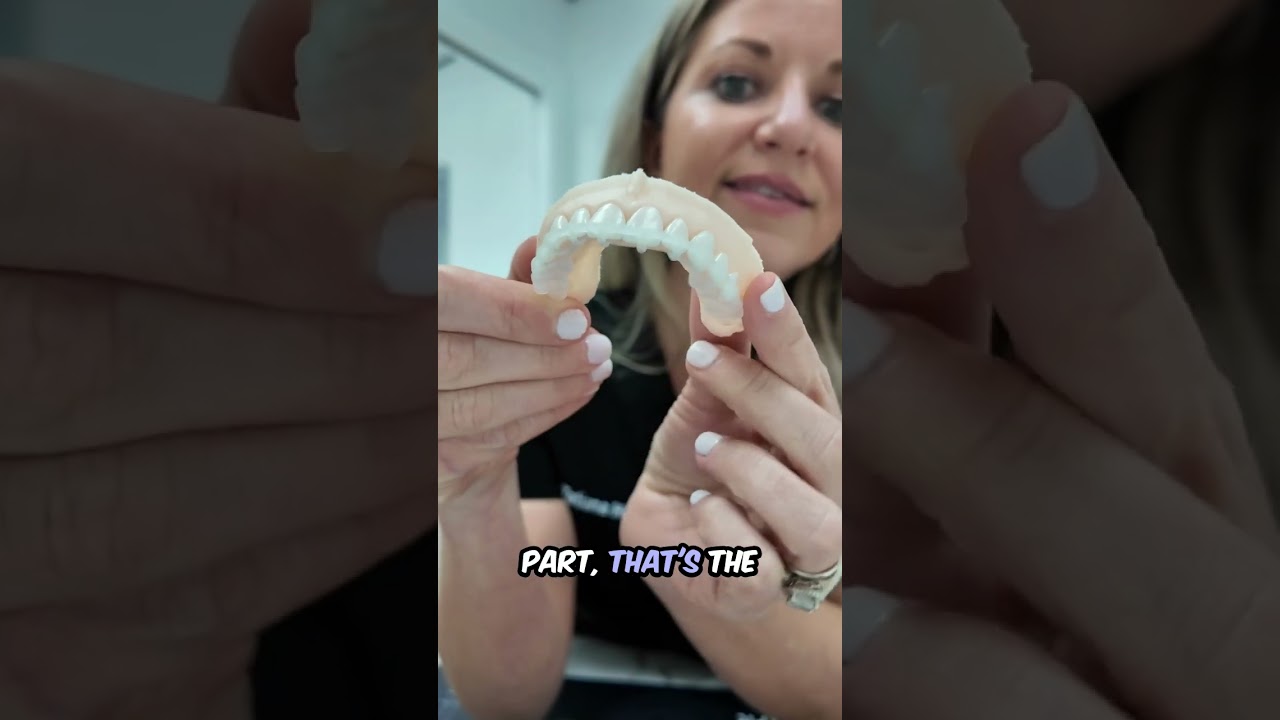 Discover the Benefits of First Fit Veneers: Fast, Precise, and Beautiful Smiles!