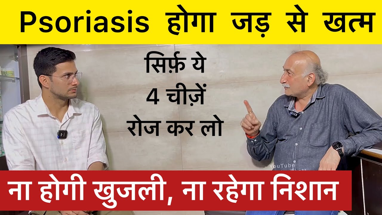 Psoriasis Treatment Without Medicine | Skin Psoriasis | Skin Disease | Himanshu Bhatt