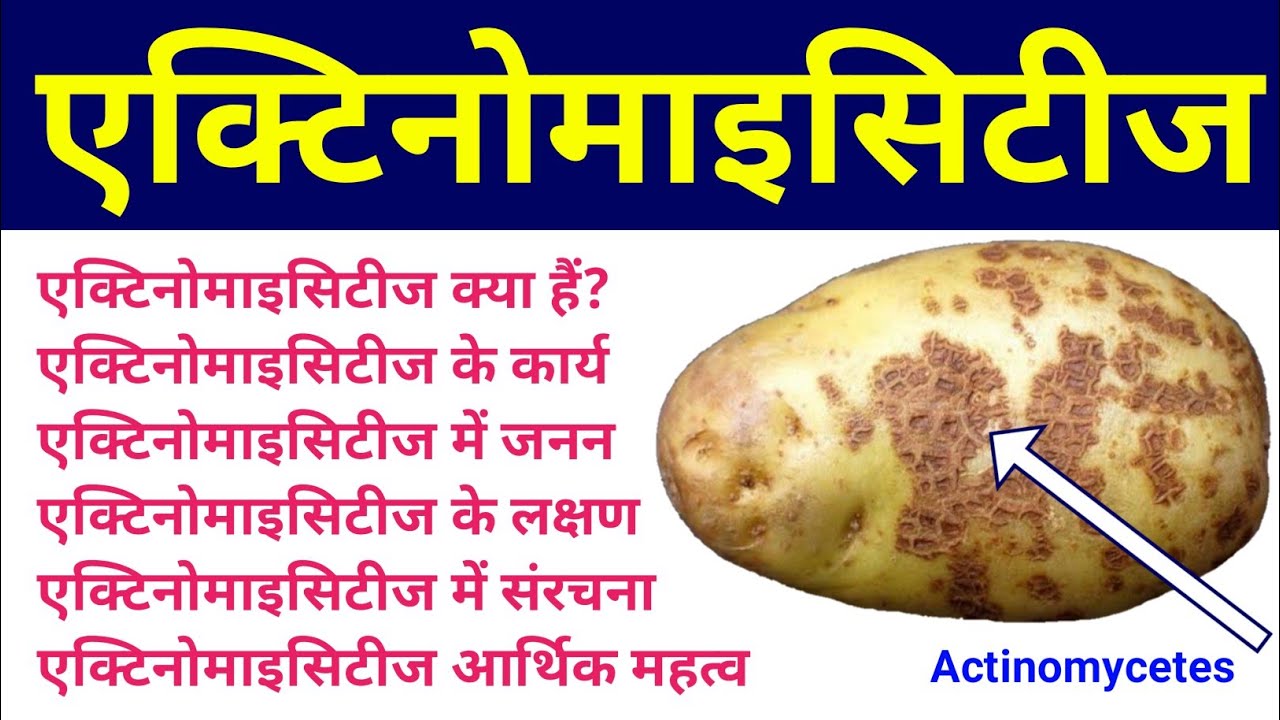 एक्टीनोमाइसीट्स | actinomycetes in hindi | actinomycetes microbiology | examples, structure, diagram