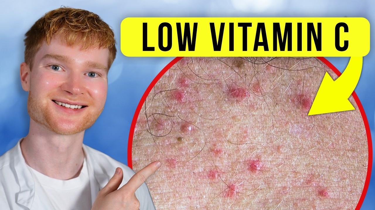 7 Signs of Vitamin C Deficiency You Can See - Doctor Explains