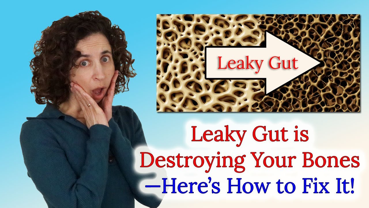 Leaky Gut is Causing Osteoporosis and Destroying Your Bones—Here’s How to Fix It!