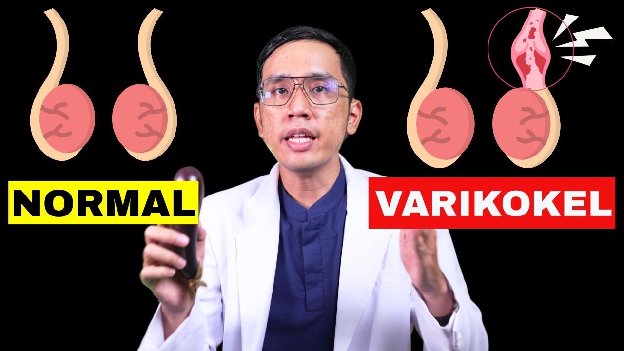 Varikokel (Varises Buah Zakar) Bikin MANDUL & NYERI?