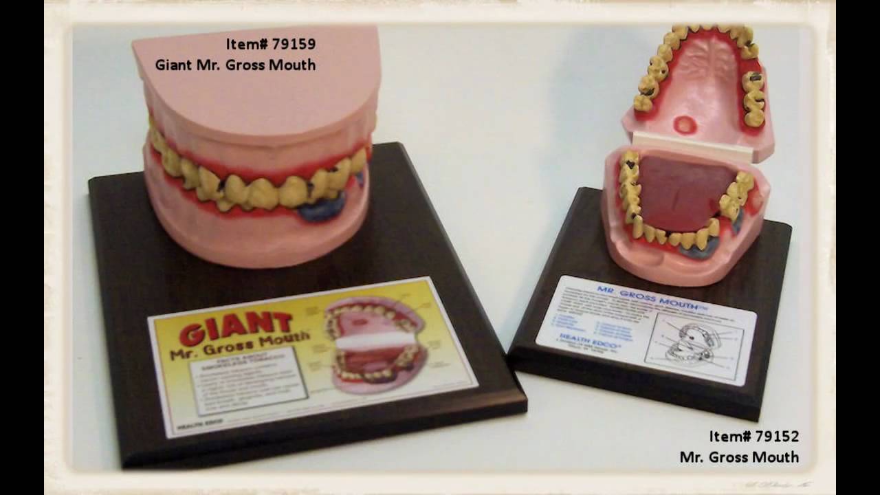 Mr. Gross Mouth (#79152)