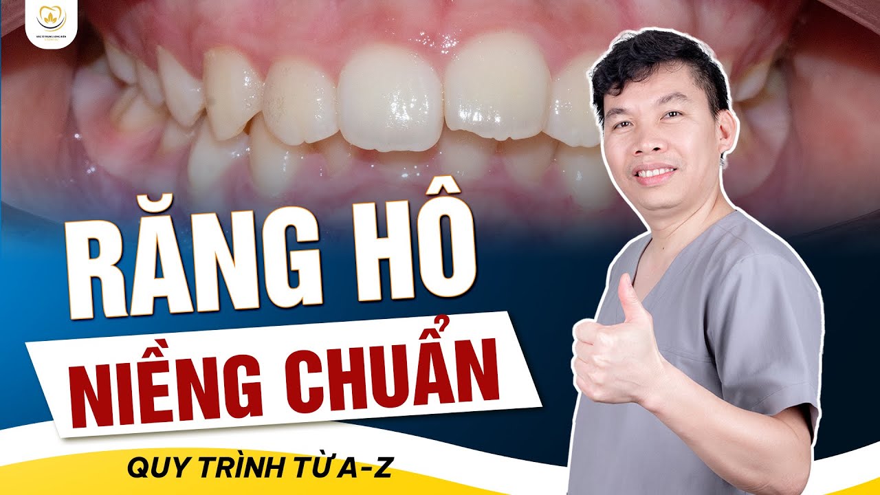 Lộ Trình Niềng Răng Hô Hiệu Quả Như Thế Nào | Bác sĩ Trung Long Biên