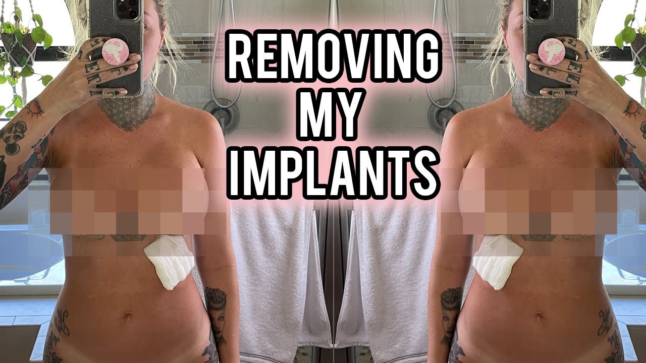 My Second Breast Augmentation Surgery