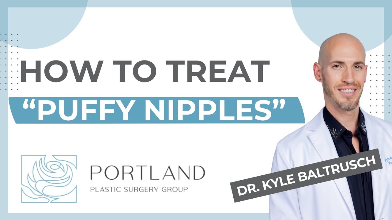 Types of gynecomastia & the best treatments for “puffy nipples”