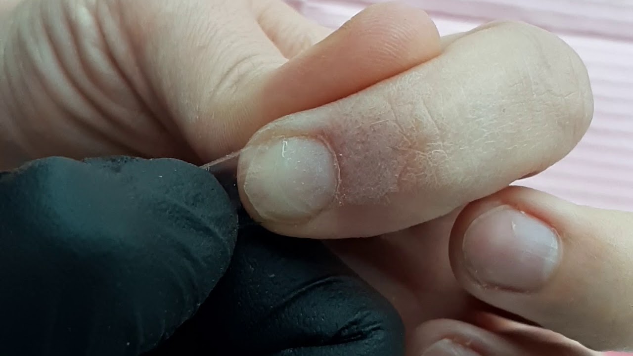 Technique résine et poudre