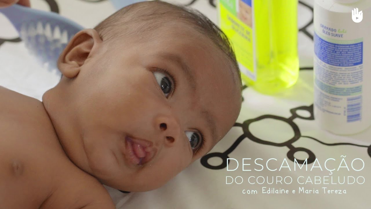 Como evitar caspas no bebê | Higiene e cuidado do bebê