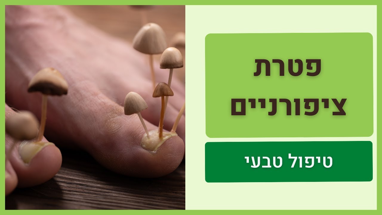 טיפול טבעי בפטרת ציפורניים - טיפים לטיפול עצמי