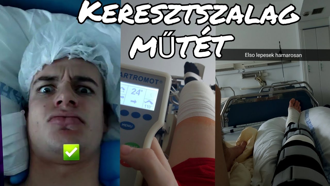 Így Zajlott a Műtétem!